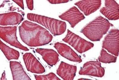 Immunohistochemistry-Paraffin: Frizzled-3 Antibody [NBP3-14325] - Immunohistochemistry of formalin-fixed, paraffin-embedded human skeletal muscle after heat-induced antigen retrieval.